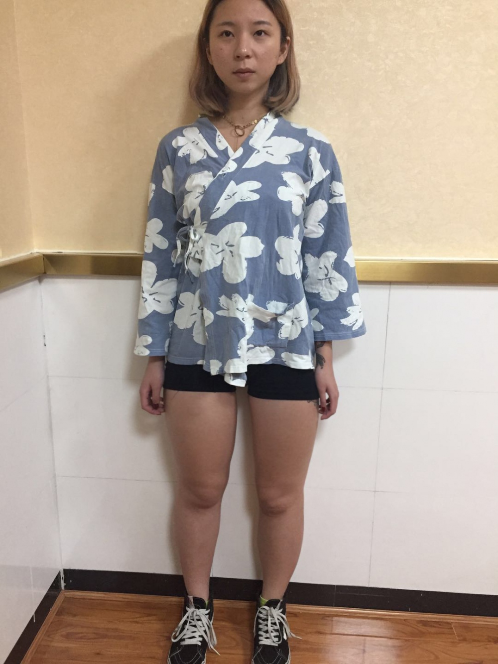 深圳鵬愛醫(yī)療整形醫(yī)生張建文做大腿吸脂怎么樣？附大腿吸脂案例效果對比圖