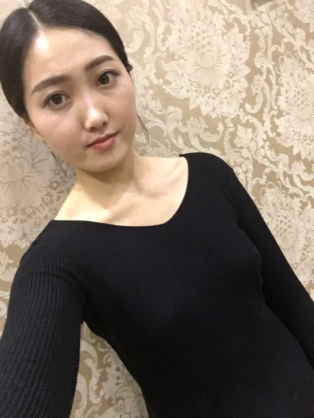 宜春美萊醫(yī)療整形醫(yī)生黃治林做自體脂肪隆胸怎么樣？附案例