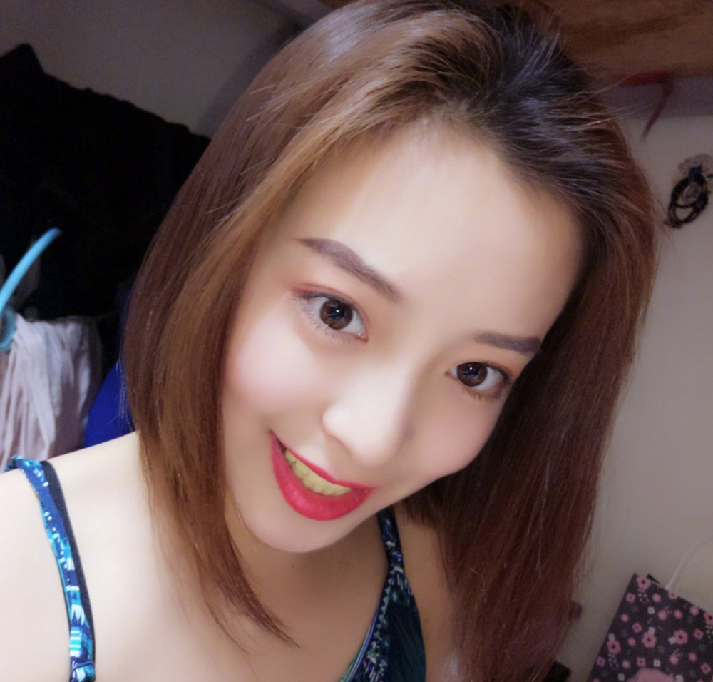 重慶樂樂欣口腔趙麗麗醫(yī)生做冷光美白效果怎么樣？附冷光美白效果對(duì)比圖