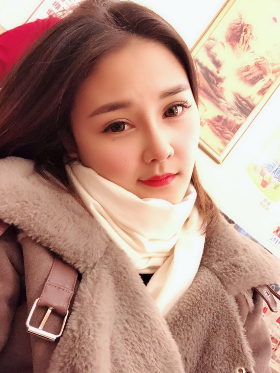 鄭州華領(lǐng)醫(yī)療美容醫(yī)院賀小虎醫(yī)生做眼綜合+鼻部整形手術(shù)效果怎么樣？