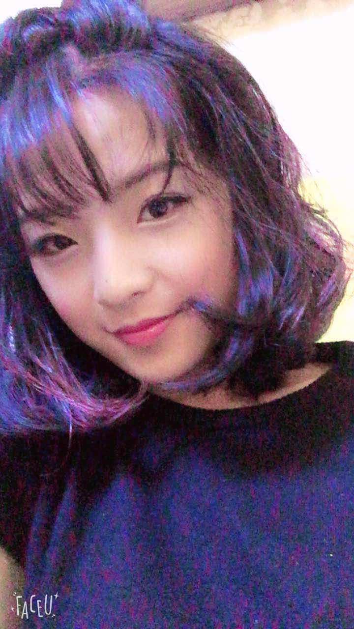鄭州名門整形醫(yī)院董斌醫(yī)生做下頜角整形怎么樣？附下頜角整形案例