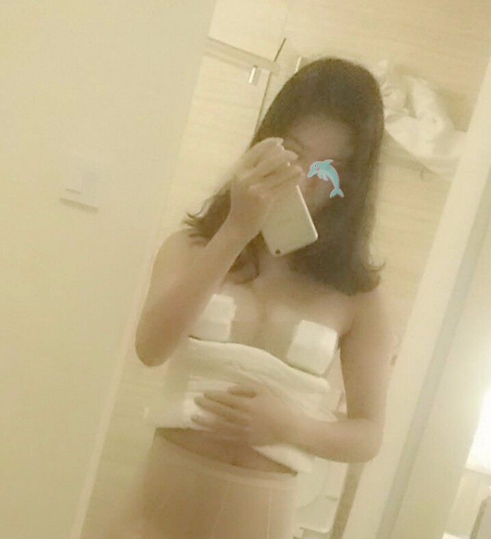 天津怡麗亞韓整形醫(yī)院林海峰醫(yī)生做自體脂肪隆胸真實(shí)案例效果對(duì)比圖