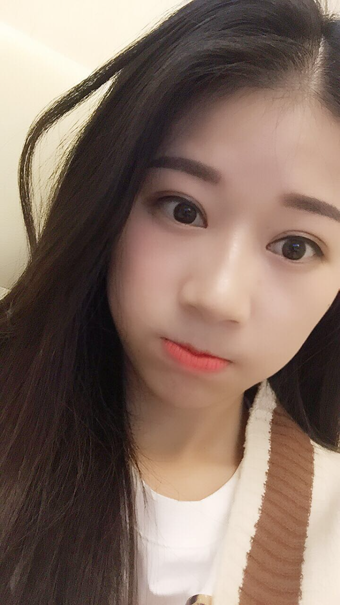 深圳晨曦醫(yī)療整形醫(yī)生吉米斯做切開雙眼皮怎么樣？吉米斯切開雙眼皮案例效果