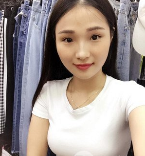 珠海萊茵醫(yī)療美容醫(yī)院崔俊溶醫(yī)生做自體脂肪隆胸效果怎么樣？附自體脂肪隆胸案例