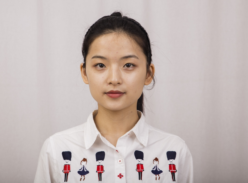 鄭州名門整形醫(yī)院董斌醫(yī)生做下頜角整形怎么樣？附下頜角整形案例