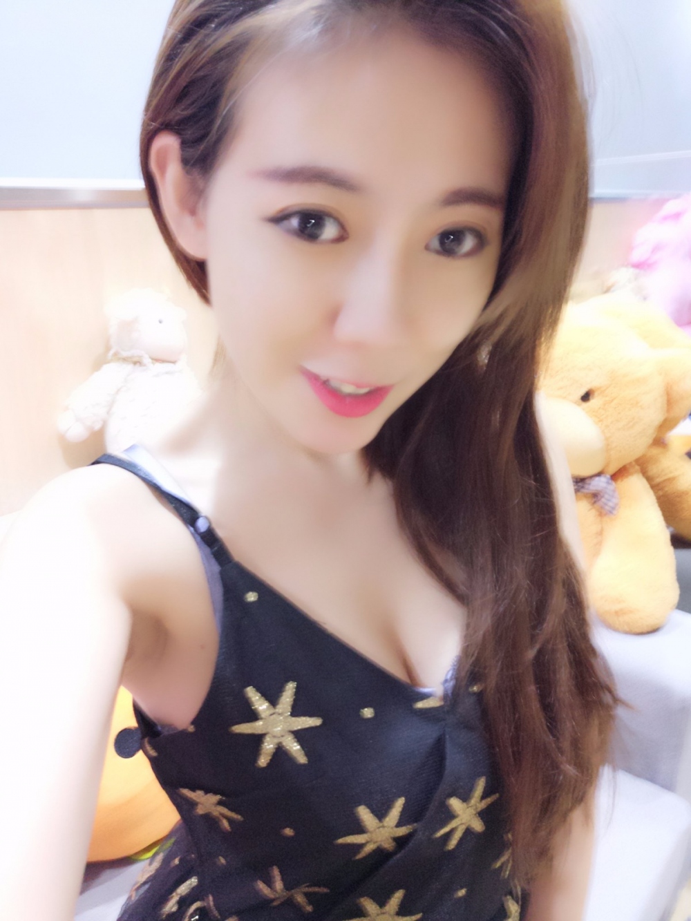 煙臺(tái)壹美整形醫(yī)院朱建瑩醫(yī)生做自體脂肪隆胸怎么樣？附自體脂肪隆胸案例