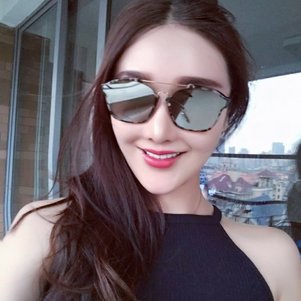 廣州柏德口腔蘭海龍醫(yī)生做瓷貼面效果怎么樣？廣州柏德口腔瓷貼面案例分享