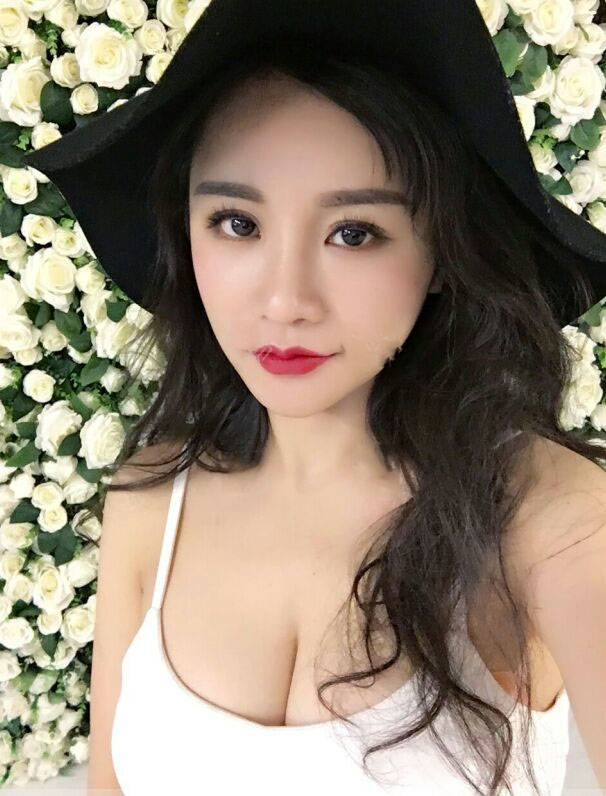 海南韓美醫(yī)學(xué)美容醫(yī)院李強(qiáng)醫(yī)生做自體脂肪隆胸效果怎么樣？附案例
