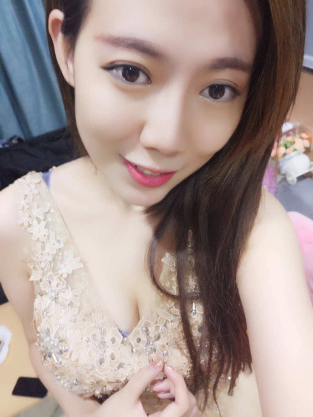 煙臺(tái)壹美整形醫(yī)院朱建瑩醫(yī)生做自體脂肪隆胸怎么樣？附自體脂肪隆胸案例