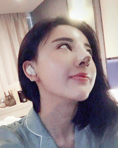 襄陽維多利亞整形醫(yī)院安邰晥醫(yī)生做鼻綜合整形怎么樣？附鼻綜合整形案例