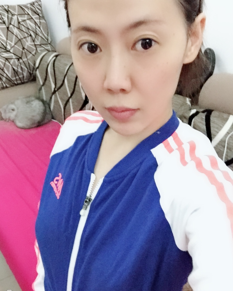 煙臺壹美整形醫(yī)院朱建瑩醫(yī)生做自體脂肪隆胸怎么樣？附自體脂肪隆胸案例