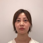 天津歐華威莎整形醫(yī)生姚玲做面部埋線提升效果怎么樣？附埋線提升案例