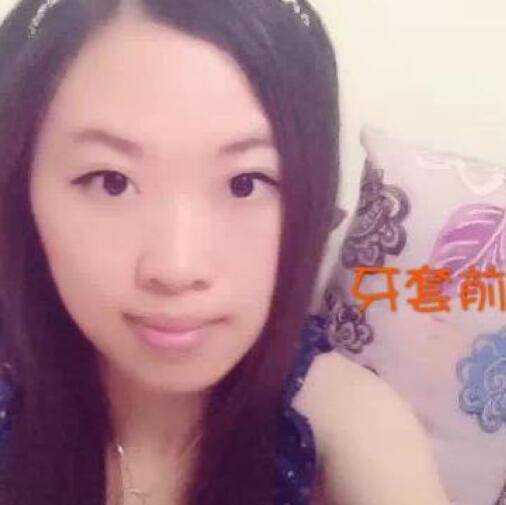 重慶嘉悅口腔醫(yī)院周繼祥醫(yī)生做金屬托槽矯正效果怎么樣？附案例效果對(duì)比圖