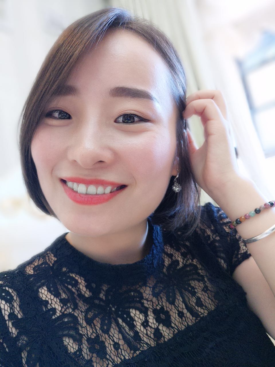 鄭州壹加壹整形醫(yī)院楊永利醫(yī)生做牙齒隱形矯正怎么樣？附牙齒隱形矯正案例