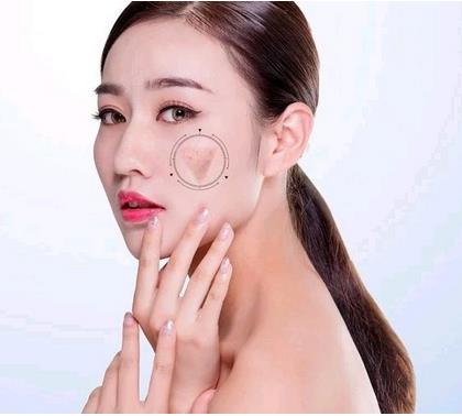 ?？诩t妝尚整形光子嫩膚