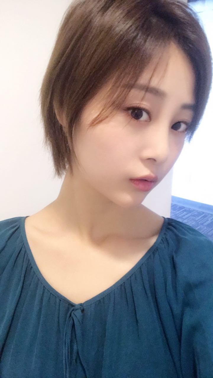 天津歐華威莎整形醫(yī)生姚玲做面部埋線提升效果怎么樣？附埋線提升案例