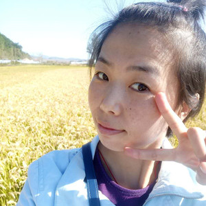 珠海蒂伊醫(yī)療整形醫(yī)生廖俊凱做激光祛斑效果怎么樣？附激光祛斑案例效果圖
