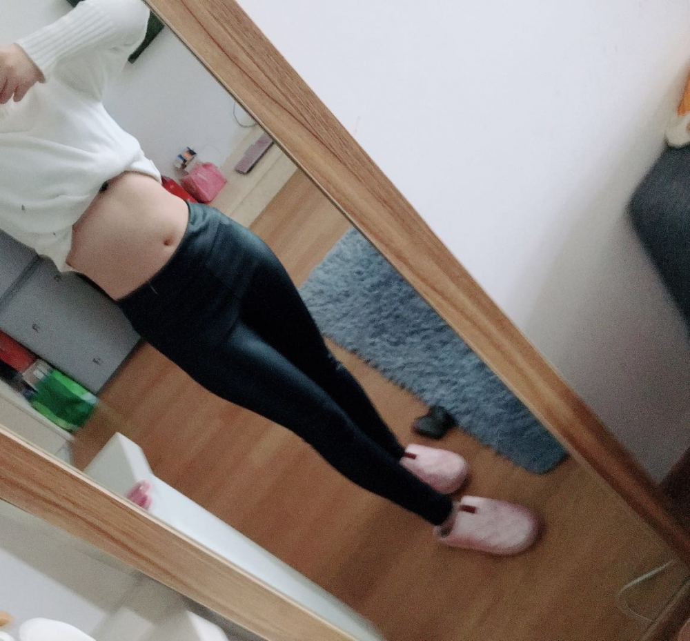 肇慶華美整形醫(yī)院陳巍醫(yī)生做腰腹吸脂效果怎么樣？附腰腹吸脂案例