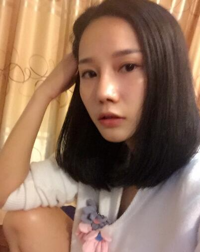 西安陽(yáng)光整形醫(yī)院邵萍醫(yī)生做鼻綜合整形怎么樣？附鼻綜合整形案例