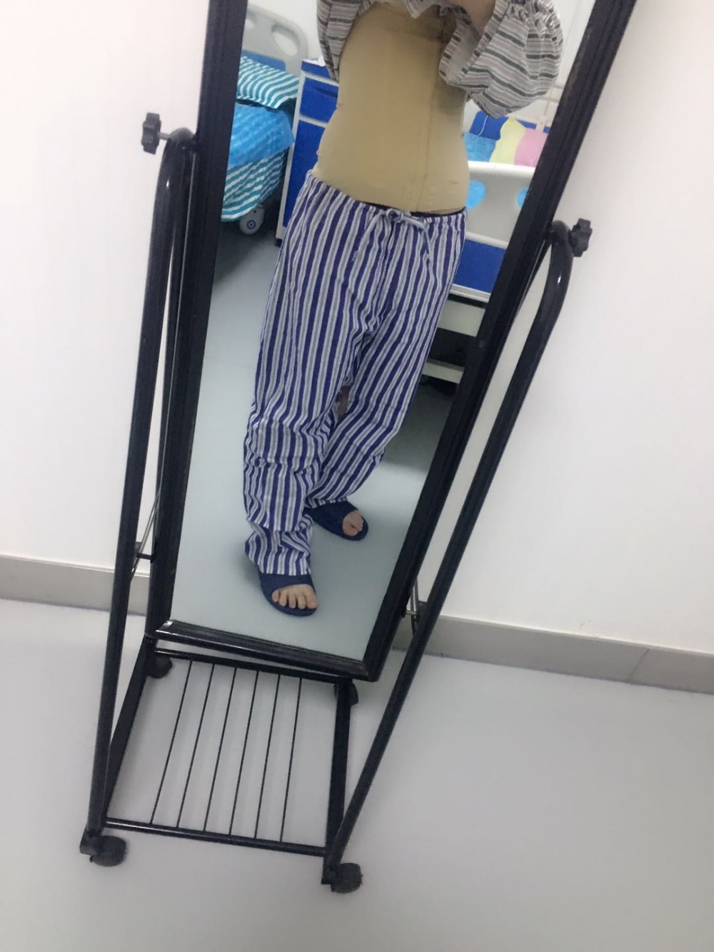 肇慶華美整形醫(yī)院陳巍醫(yī)生做腰腹吸脂效果怎么樣？附腰腹吸脂案例