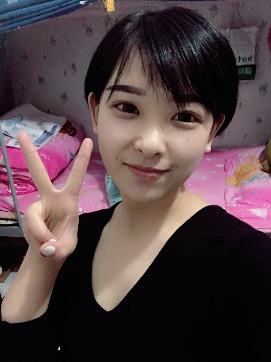 武漢肽慕醫(yī)美整形醫(yī)院楊婉菱醫(yī)生做面部吸脂效果怎么樣？附面部吸脂案例