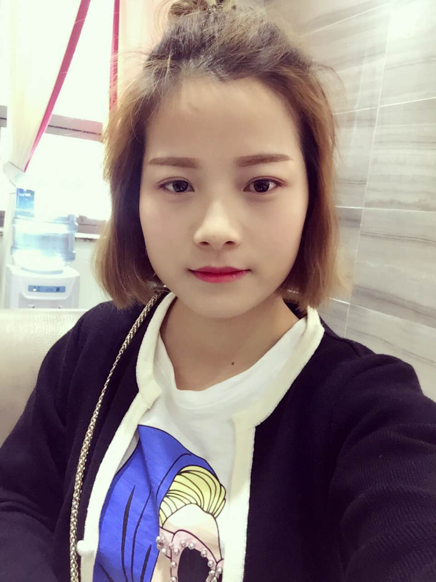 西安藝星醫(yī)療整形醫(yī)院李國玲做鼻綜合整形怎么樣？附李國玲鼻綜合整形案例