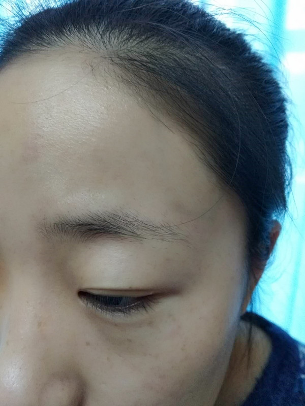 長沙愛思特醫(yī)療美容醫(yī)院做半永久紋眉怎么樣？附彭子娟醫(yī)生案例效果圖