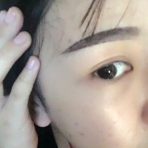 大同清木整形醫(yī)院張樹(shù)霞醫(yī)生做半永久紋眉效果如何？附半永久紋眉效果圖
