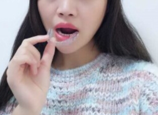 廈門拜博口腔醫(yī)院醫(yī)生張忠做牙齒隱形矯正怎么樣？附案例效果對比圖