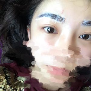 大同清木整形醫(yī)院張樹(shù)霞醫(yī)生做半永久紋眉效果如何？附半永久紋眉效果圖