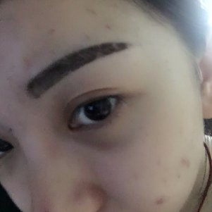 大同清木整形醫(yī)院張樹(shù)霞醫(yī)生做半永久紋眉效果如何？附半永久紋眉效果圖