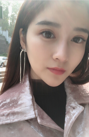 張家港唯恩整形醫(yī)院陳天杰醫(yī)生切開雙眼皮案例效果對(duì)比圖