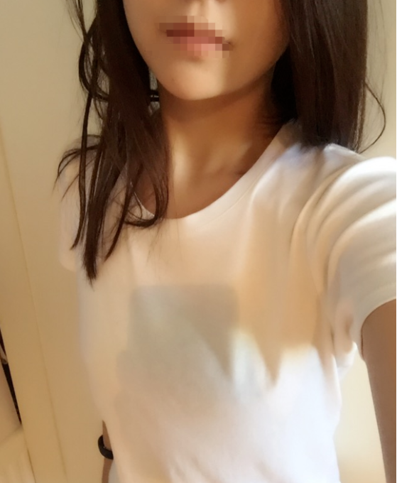 東莞韓美整形醫(yī)院醫(yī)生黃玉潔做假體隆胸怎么樣？附案例效果圖