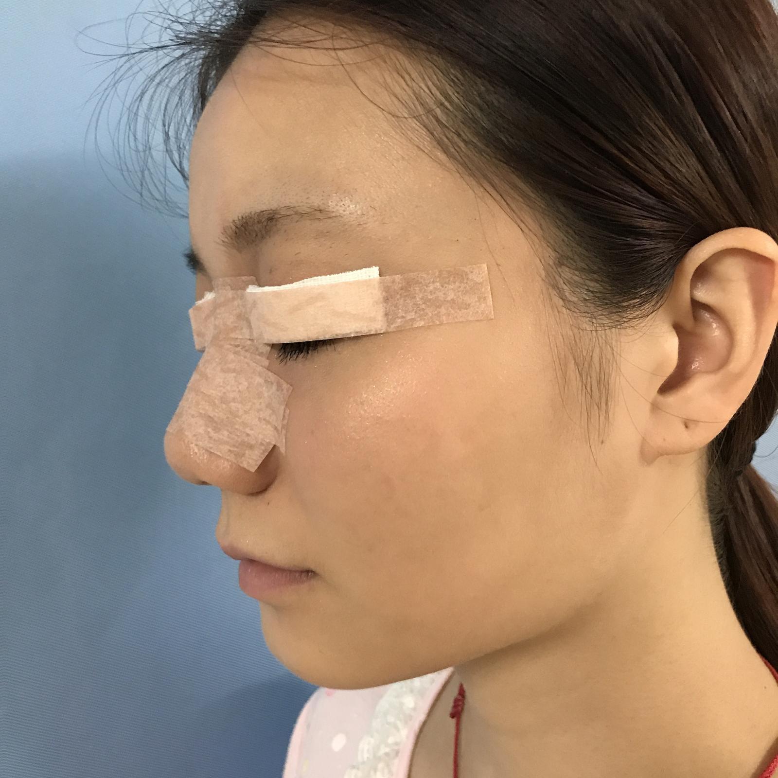 武漢華美整形醫(yī)院醫(yī)生王向陽做眼綜合整形怎么樣？附案例效果圖