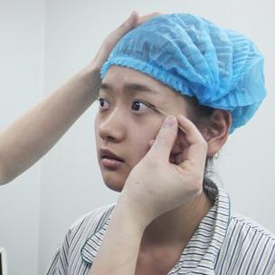 武漢伽美醫(yī)療美容醫(yī)院醫(yī)生鄭泰成做切開雙眼皮怎么樣？附案例