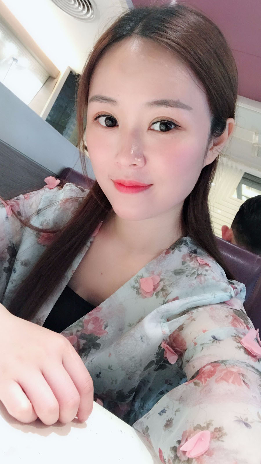 廣東韓妃醫(yī)療美容醫(yī)院做切開雙眼怎么樣？附案例效果圖