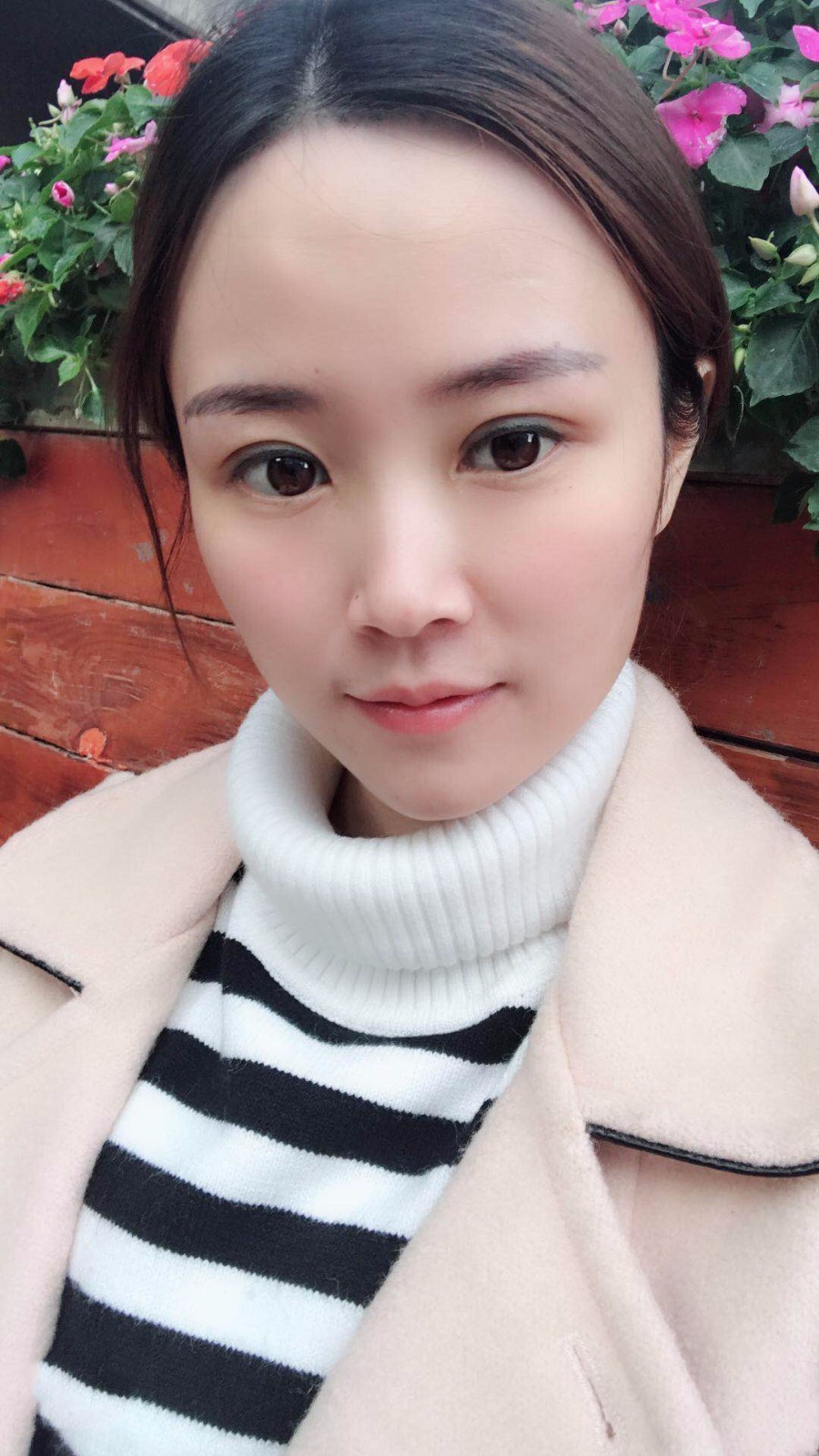 廣東韓妃醫(yī)療美容醫(yī)院做切開雙眼怎么樣？附案例效果圖