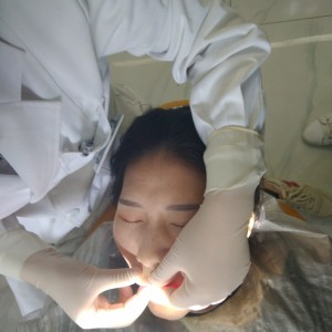 黔西南興義京州口腔醫(yī)院醫(yī)生徐勇做牙貼面怎么樣？附案例效果對比圖