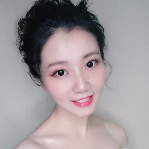 武漢華美整形醫(yī)院醫(yī)生王向陽做眼綜合整形怎么樣？附案例效果圖