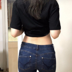 北京可思美整形醫(yī)院醫(yī)生斯勤做腰腹吸脂怎么樣？附案例效果對比圖