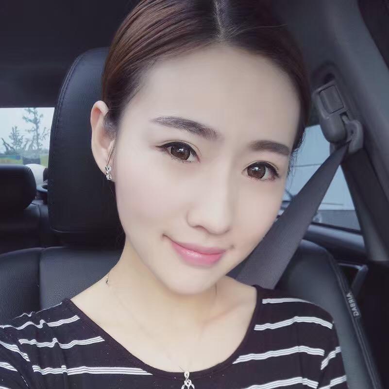 貴陽美和諧醫(yī)療整形醫(yī)生孫澤芳做切開雙眼皮效果怎么樣？附案例效果對比圖