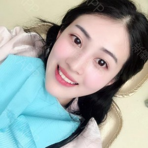 上?？仆呖谇会t(yī)院醫(yī)生鄧建儒做牙齒冷光美白怎么樣？附案例效果對(duì)比圖