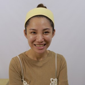 保定東陽口腔醫(yī)院醫(yī)生白小青做牙齒冷光美白怎么樣？附案例效果對(duì)比圖