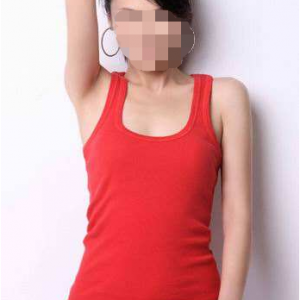 長(zhǎng)沙柒和醫(yī)療整形醫(yī)生鐘滔做手臂吸脂怎么樣？附案例效果對(duì)比圖