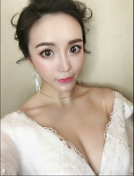 重慶當(dāng)代整形美容醫(yī)院醫(yī)生楊健做假體隆胸怎么樣？附案例