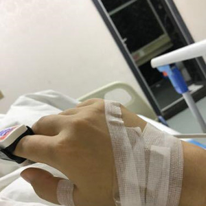 河南協(xié)和醫(yī)院整形外科醫(yī)生騰利做自體脂肪隆胸怎么樣？附案例效果對(duì)比圖