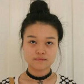 鄭州管城中醫(yī)院整形美容中心醫(yī)生張秀英做注射瘦臉怎么樣？附除皺瘦臉案例效果圖