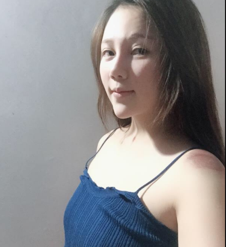北京東方和諧醫(yī)療整形診所馮斌醫(yī)生做假體隆胸怎么樣？附案例效果對比圖