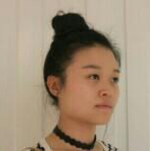 鄭州管城中醫(yī)院整形美容中心醫(yī)生張秀英做注射瘦臉怎么樣？附除皺瘦臉案例效果圖