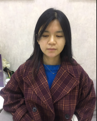 上海時(shí)光整形外科醫(yī)院醫(yī)生何晉龍做假體隆胸怎么樣？附案例效果對(duì)比圖